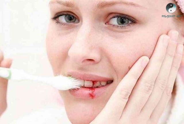 Chiêm bao thấy đánh răng bị chảy máu thường là những điềm xấu